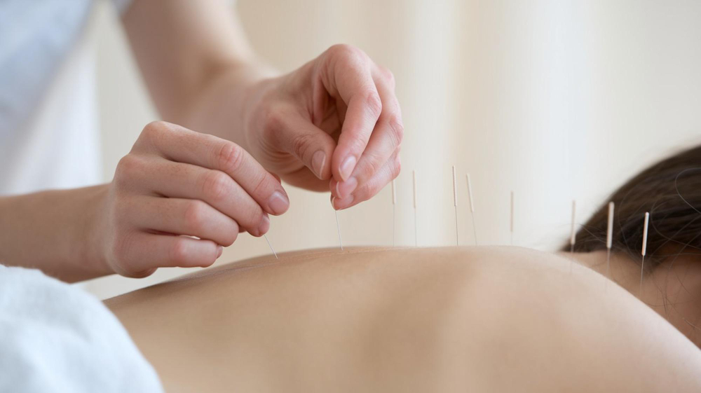 針灸調理